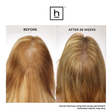 Hairmax LaserBand 82 ComfortFlex Hair Growth Device / 82 ComfortFlex