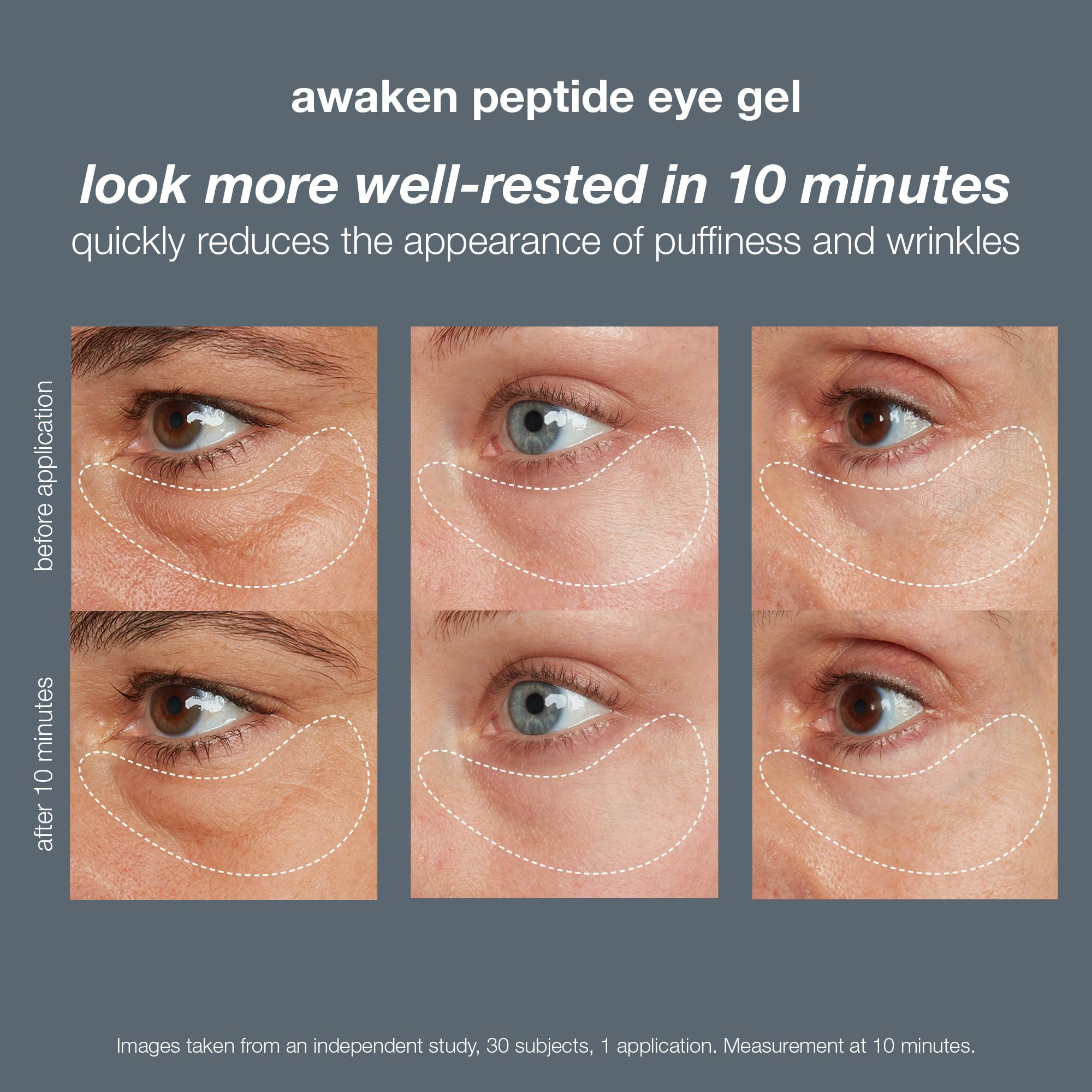 Dermalogica Awaken Peptide Eye Gel / 0.5OZ