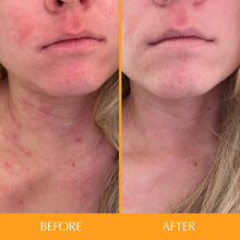 Hairtamin Skintamin Vitamins / 30 capsules