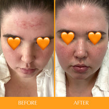 Hairtamin Skintamin Vitamins / 30 capsules