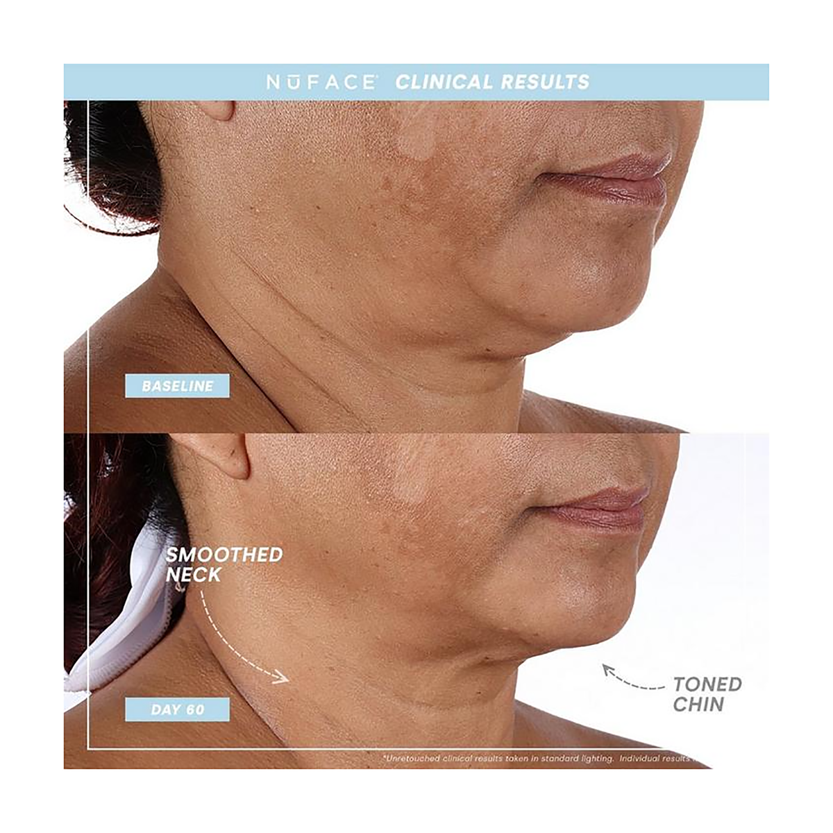 Nuface Mini+ Sandy Rose, image 26850544976022