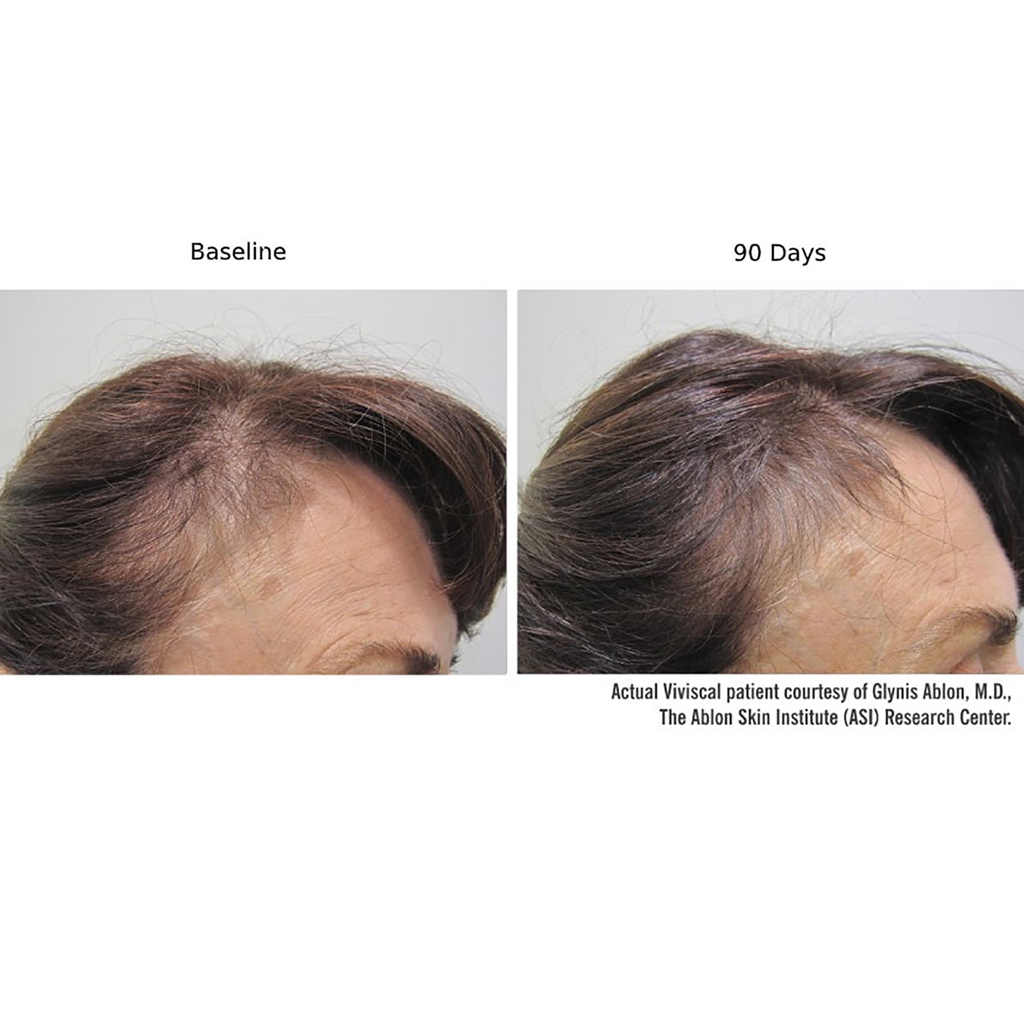 Viviscal Professional Advanced Hair Health Supplements / 60CT