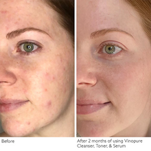 Caudalie Vinopure Serum / 1.OZ