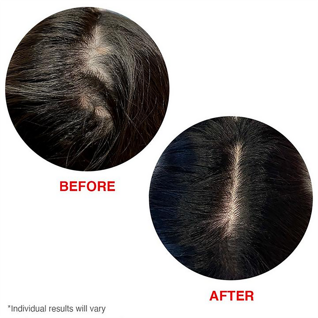 Hairtamin Scalp Serum / 2OZ thumbnail 3
