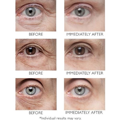 Peter Thomas Roth Instant FirmX Eye / 1OZ, image 23119474360470