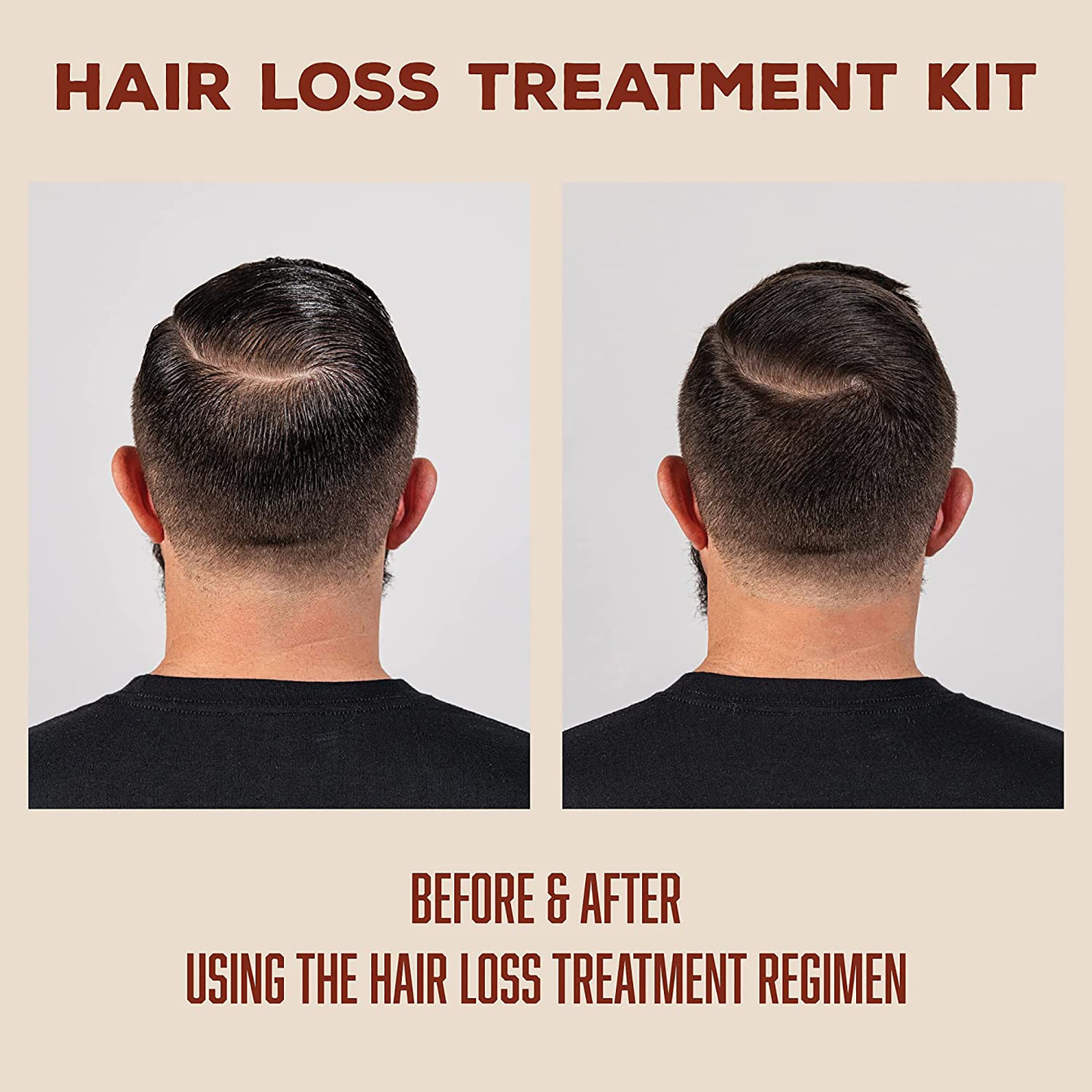 Suavecito Hair Loss Treatment Kit